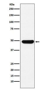 Anti-UAP56 Rabbit Monoclonal Antibody Boster Bio