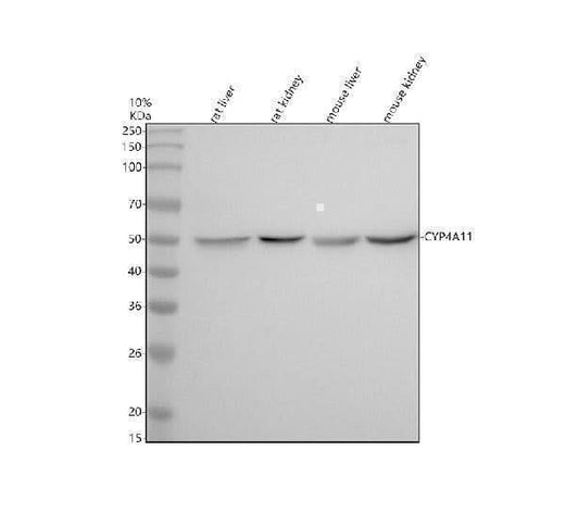 Anti-Cytochrome P450 4A Rabbit Monoclonal Antibody Boster Bio