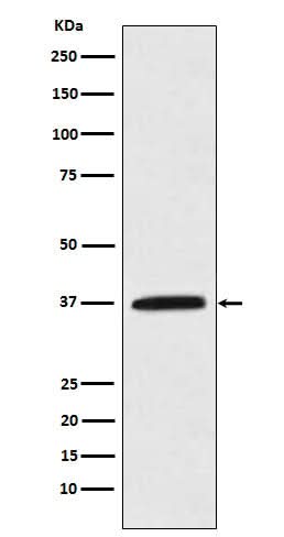 Anti-Kallikrein 5 Rabbit Monoclonal Antibody Boster Bio
