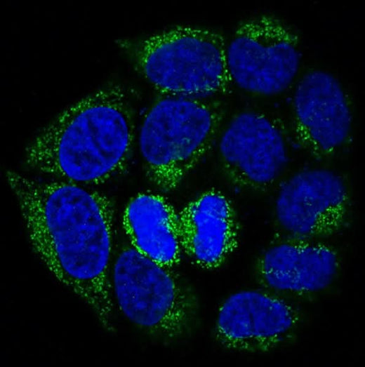 Anti-Bad Rabbit Monoclonal Antibody Boster Bio