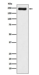 Anti-Laminin gamma 1 Rabbit Monoclonal Antibody Boster Bio