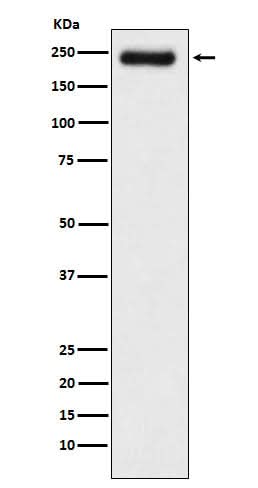 Anti-Laminin gamma 1 Rabbit Monoclonal Antibody Boster Bio