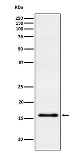 Anti-gamma Synuclein Rabbit Monoclonal Antibody Boster Bio