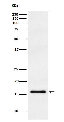 Anti-gamma Synuclein Rabbit Monoclonal Antibody Boster Bio