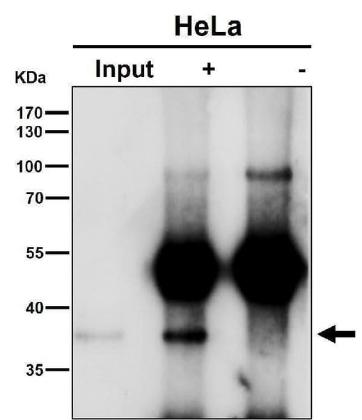 Anti-NFYA Rabbit Monoclonal Antibody Boster Bio