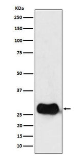 Anti-HLA DMB Rabbit Monoclonal Antibody Boster Bio