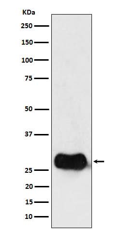 Anti-HLA DMB Rabbit Monoclonal Antibody Boster Bio