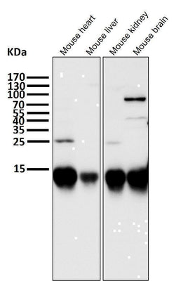 Anti-Cytochrome C CYCS Rabbit Monoclonal Antibody Boster Bio