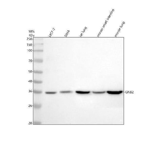 Anti-GNB2 Rabbit Monoclonal Antibody Boster Bio
