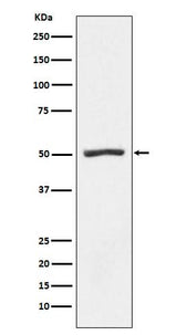 Anti-PSMD4 Rabbit Monoclonal Antibody Boster Bio