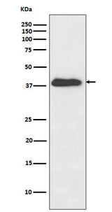 Anti-XLF Rabbit Monoclonal Antibody Boster Bio