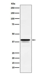 Anti-FOXF1 Rabbit Monoclonal Antibody Boster Bio