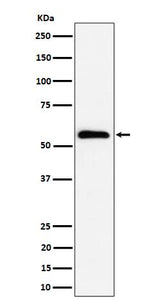 Anti-PNK / PNKP Rabbit Monoclonal Antibody Boster Bio