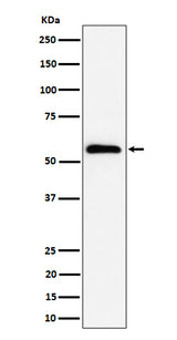 Anti-PNK / PNKP Rabbit Monoclonal Antibody Boster Bio