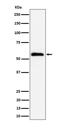 Anti-PNK / PNKP Rabbit Monoclonal Antibody Boster Bio