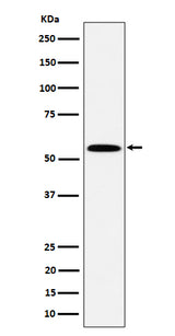 Anti-PNK / PNKP Rabbit Monoclonal Antibody Boster Bio