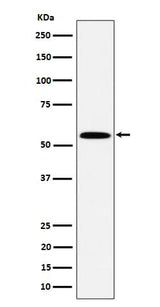 Anti-PNK / PNKP Rabbit Monoclonal Antibody Boster Bio