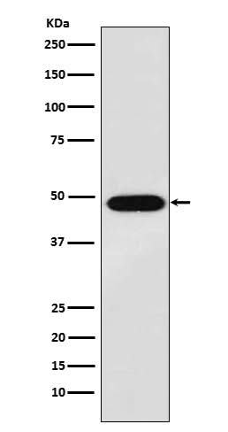 Anti-MAGE 1 Rabbit Monoclonal Antibody Boster Bio