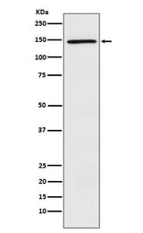 Anti-PLCG2 Rabbit Monoclonal Antibody Boster Bio