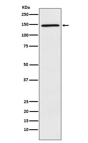 Anti-PLCG2 Rabbit Monoclonal Antibody Boster Bio