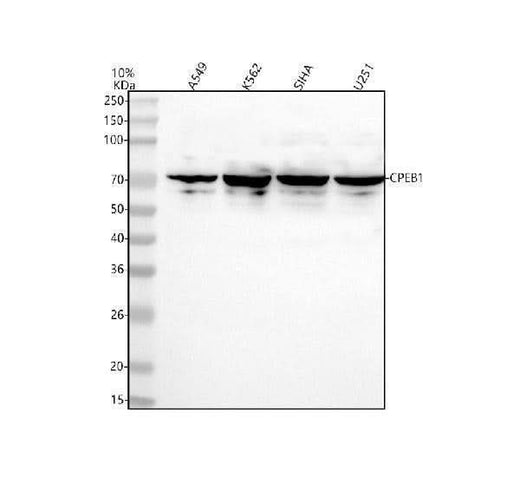 Anti-CPEB1 Rabbit Monoclonal Antibody Boster Bio