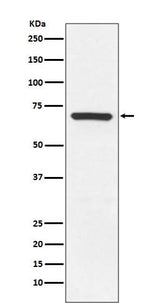 Anti-MEKK3 MAP3K3 Rabbit Monoclonal Antibody Boster Bio