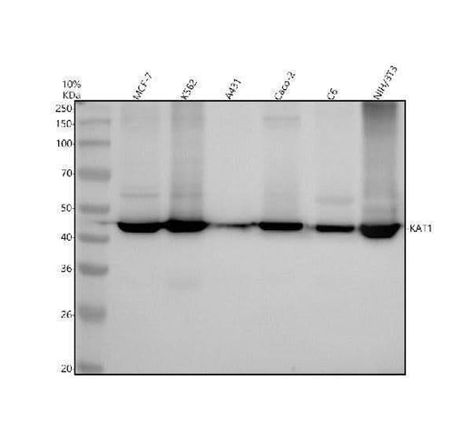Anti-KAT1 / HAT1 Rabbit Monoclonal Antibody Boster Bio