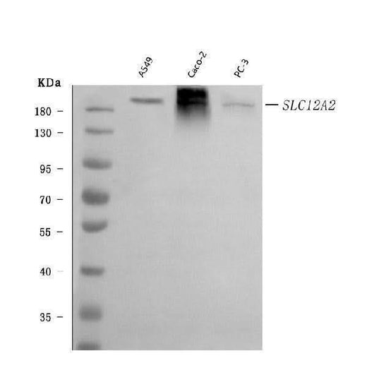 Anti-NKCC1/SLC12A2 Antibody Picoband® (monoclonal, 6G7D2 Boster Bio