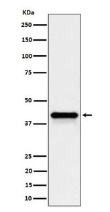 Anti-Wnt16 Rabbit Monoclonal Antibody Boster Bio