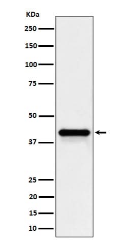 Anti-Wnt16 Rabbit Monoclonal Antibody Boster Bio