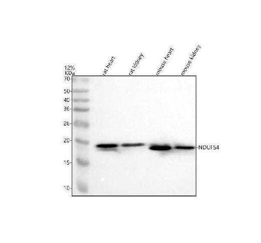 Anti-Ndufs4 Rabbit Monoclonal Antibody Boster Bio