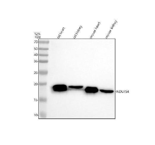 Anti-NDUFS4 Rabbit Monoclonal Antibody Boster Bio