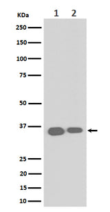 Anti-ELOVL5 Rabbit Monoclonal Antibody Boster Bio