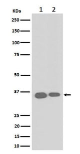 Anti-ELOVL5 Rabbit Monoclonal Antibody Boster Bio