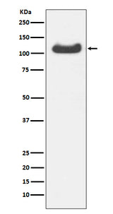 Anti-HSPA4 Rabbit Monoclonal Antibody Boster Bio