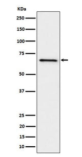 Anti-GRK6 Rabbit Monoclonal Antibody Boster Bio