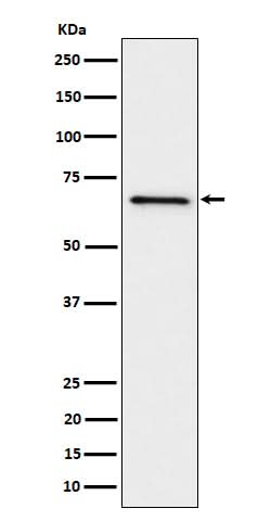 Anti-GRK6 Rabbit Monoclonal Antibody Boster Bio