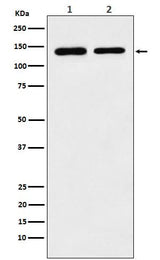 Anti-SA2 Rabbit Monoclonal Antibody Boster Bio