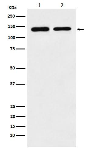 Anti-SA2 Rabbit Monoclonal Antibody Boster Bio