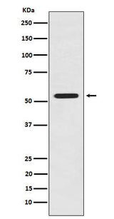 Anti-LMAN1 Rabbit Monoclonal Antibody Boster Bio