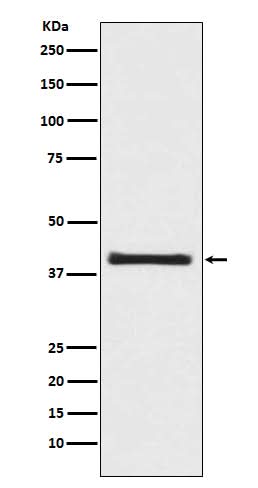 Anti-PRAS40 AKT1S1 Rabbit Monoclonal Antibody Boster Bio