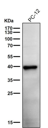 Anti-Phospho-PRAS40 (T246) Rabbit Monoclonal Antibody Boster Bio
