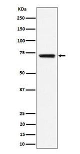 Anti-BLNK Rabbit Monoclonal Antibody Boster Bio