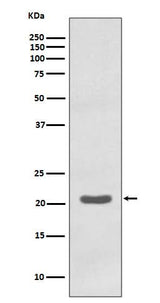 Anti-MTCO2 Rabbit Monoclonal Antibody Boster Bio