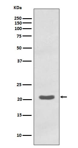 Anti-MTCO2 Rabbit Monoclonal Antibody Boster Bio