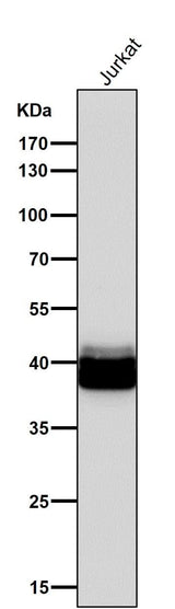 Anti-PAR4 Rabbit Monoclonal Antibody Boster Bio