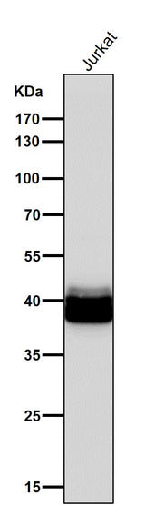 Anti-PAR4 Rabbit Monoclonal Antibody Boster Bio
