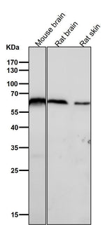 Anti-U2AF65 Rabbit Monoclonal Antibody Boster Bio