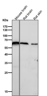 Anti-U2AF65 Rabbit Monoclonal Antibody Boster Bio