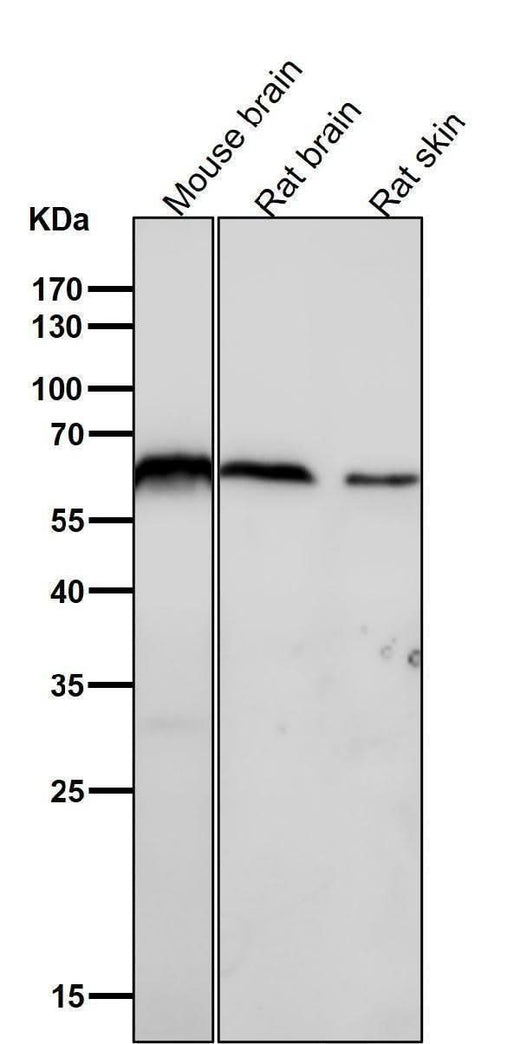 Anti-U2AF65 Rabbit Monoclonal Antibody Boster Bio